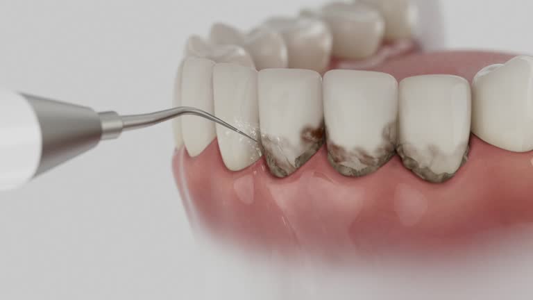 Trusted Invisalign Clear Aligners service in Inkster, MI - Dentist Open Now